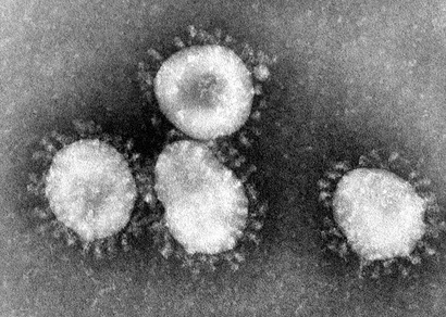 코로나 바이러스를 전자현미경으로 관찰한 모습. 모양이 왕관 혹은 광환을 닮았다 하여 코로나 바이러스라는 이름이 붙었다. 사진=미국 질병통제센터 홈페이지